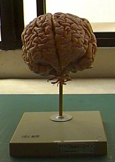 人腦模型圖